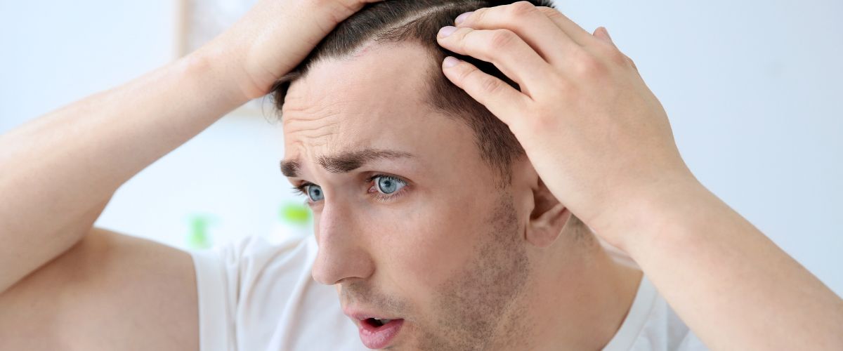 Young man with hair loss problems